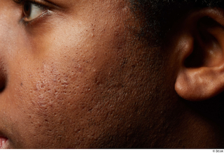 HD Face Skin Canaan-Allvince Epps cheek face skin pores skin…